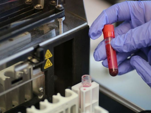 Ученые выяснили, какая группа крови меньше всего склонна к онкологии